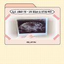 평촌하늘약국 | Ep5. 임신준비 &amp; 평촌 마리아 [1차 시험관 ] : 2차 피검사 + 아기집확인 + 계류유산판정