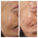 라비에 에스테틱 이미지