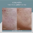 피부맑음 에스테틱