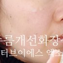 브이에스힐링 | 주름개선화장품 추천 닥터브이에스 엑소좀 에센스 사용후기