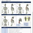 씨엔에스정형외과의원 | 우리 아이 잘 크고 있나? - 자세 교정 운동