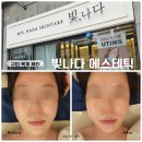피부빛나다 | 구미피부관리 알테온리프팅 리얼후기, 빛나다에스테틱