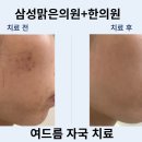 삼성맑은의원한의원 네이버블로그