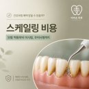 건강정보 스케일링 총정리 / 보험 적용 주기, 치료 과정, 후 주의사항, 이아소치과
