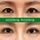 아이케이성형외과의원 네이버블로그