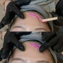 헤어502 | 삼자이마교정 이렇게 자연스럽다고? 리쏘왁싱 선릉점 헤어라인왁싱 후기