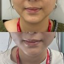 티나코리아 | [인터참코리아 2025 박람회] 직접 참가한 부스 더마솔루션X티나랩 3일간의 기록