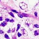 부여육종 이미지