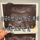 수정-17 | [동탄 디온] 인공수정 2차 더블링 성공, 17일차~20일차 임테기 (임테기 역전으로 아기집 확인)