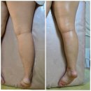 여가뷰티 | [수성구에스테틱] 서인애 뷰티샵 :: 하체관리후 부종 쏙 빠진 후기