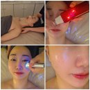 온유에스테틱 | 운양동 피부관리 온유에스테틱 / 물방울 리프팅으로 물광 후기 (가성비+꼼꼼함)
