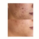 비나인에스테틱 이미지