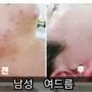 뷰티힐에스테틱