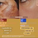 AI 시대의 변화와 아로마테라피의 필요성