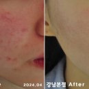리유 이미지