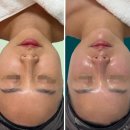 수원-1090 | 수원 인계동 윤곽관리, “얼굴만” 만지는 관리로는 부족하셨나요?