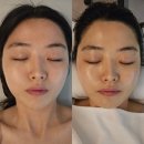 청구역 3번 출구 | 약수에스테틱 중 웨딩관리로 유명한 릿에스테틱 후기