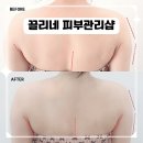 끌리네 | 전주 끌리네피부관리 신시가지효자점 10년 경력 원장님의 등관리 후기