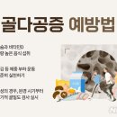 맹추위에 근육·관절 경직…60대이상 여성 &#39;골절 주의보&#39; 이미지