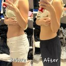 온누리복대약국 | 강남 압구정다이어트 코어스컬프 복부관리 바이오포톤 효과 찐후기 전후비교 만족도 1000% 추천