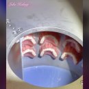 (주)한국심미치과기공소 | 그래피 2026 LMT 에서 추가되는 파트너? 루크강?