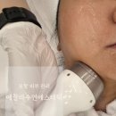 수연메디칼 | 포항 피부 관리 에끌라수연에스테틱 리프팅 솔직 후기