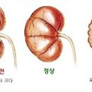 신장군집