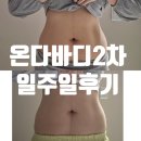 2 | 송도 온다 바디 리프팅 2차 후기 뱃가죽이 얇아지기 시작