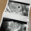 이정례의원 이미지