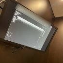 아주속편한의원 | 맘모톰 시술 후기_예젤유의원 이원경 원장님