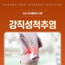 류마통내과의원 | 류마통내과의원 강직성척추염, 단순 허리통증과 다른 점