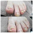 닥터아이티엔 러블리 네이버블로그