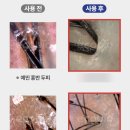 디에스투