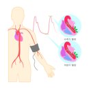 고혈압 / 삼성서울병원 순환기내과, 가정의학과 이미지