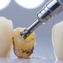 부천청담네오플란트치과의원 이미지