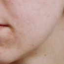 이소약국 이미지