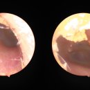 한미보청기 이미지