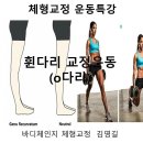 대전오다리엑스다리 교정운동 이미지