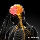 잠수병[Decompression sickness, Diver's disease] 이미지