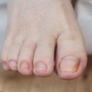 대전레푸스다솜네일 네이버블로그