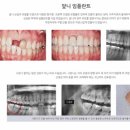 매일미소치과의원 네이버블로그