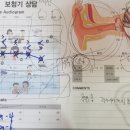 소리청보청기 이미지