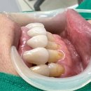 좋은날치과기공소 이미지