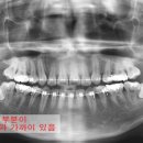 뿌리샘치과의원 이미지