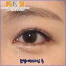 에스라인 이미지