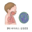 RS 바이러스 주의보 이미지