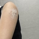 다나을한의원 | 강남역 모공각화증 치료 한의원 내돈내산 리얼 후기(비용,예약 정보)