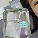아이멍 | 아이리쥬란 내돈내산 솔직 후기 효과 가격 멍 붓기 정품인증 이벤트