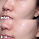 퀸헬스케어 | 붉은기 트러블 EGF장벽크림 지피덤 데일리 민감성 크림 2통째 사용 후기