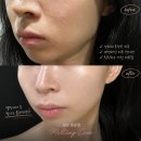 255 | [대전] 피부관리 설브 용문점 요즘 핫한 멜팅광채케어 받고 물광피부된 후기